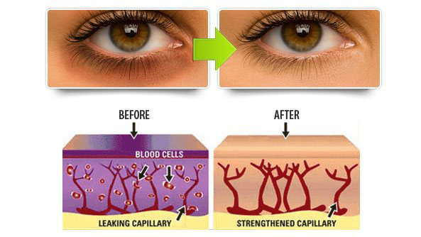 Vivexin Before and After