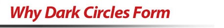 Why Dark Circles Form
